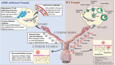 The Role of AIRE Deficiency in Infertility and Its Potential Pathogenesis